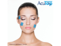 ACUTOP Acupuncture Grid Tape Type A | 180 pieces